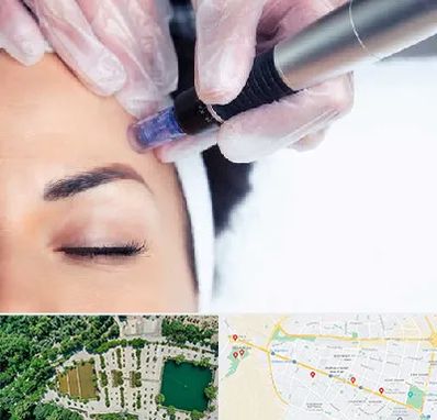 کلینیک مزوتراپی صورت در وکیل آباد مشهد