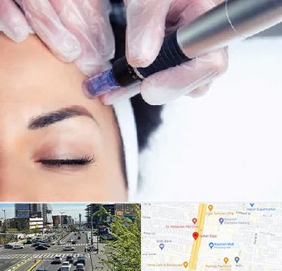 کلینیک مزوتراپی صورت در ستاری 