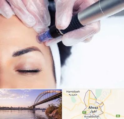 کلینیک مزوتراپی صورت در اهواز