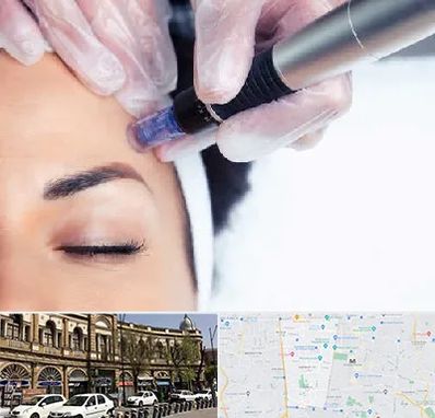 کلینیک مزوتراپی صورت در منطقه 11 تهران 