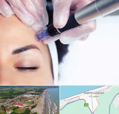 کلینیک مزوتراپی صورت در محمودآباد