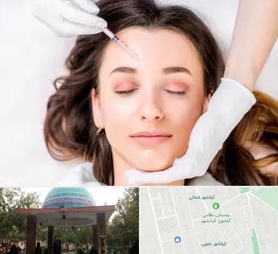 مزوتراپی ابرو در کیانشهر