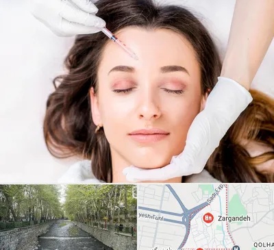 مزوتراپی ابرو در زرگنده