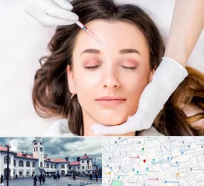 مزوتراپی ابرو در میدان شهرداری رشت