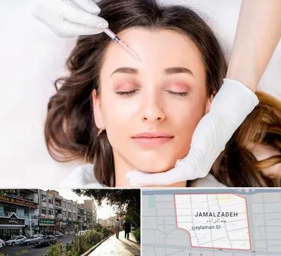 مزوتراپی ابرو در خیابان جمالزاده