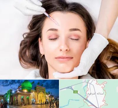 مزوتراپی ابرو در آستانه اشرفیه