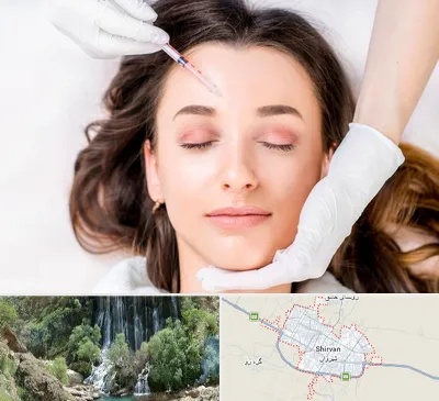 مزوتراپی ابرو در شیروان