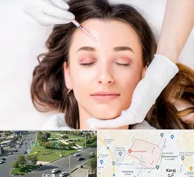 مزوتراپی ابرو در شاهین ویلا کرج
