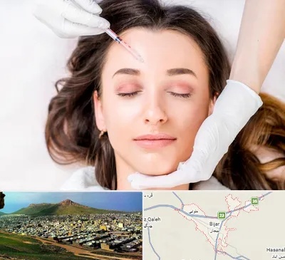 مزوتراپی ابرو در بیجار
