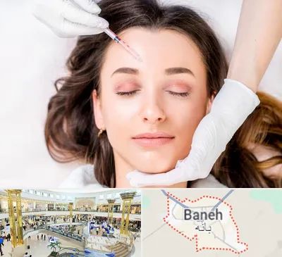 مزوتراپی ابرو در بانه