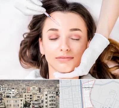 مزوتراپی ابرو در اسکندری