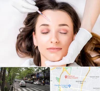 مزوتراپی ابرو در ظفر 