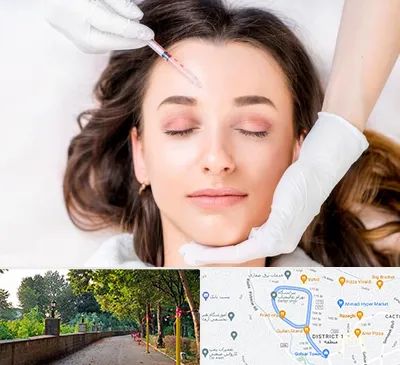 مزوتراپی ابرو در فلکه گاز رشت