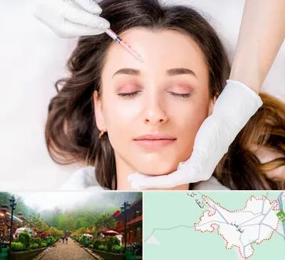 مزوتراپی ابرو در فومن