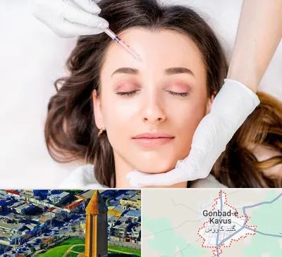 مزوتراپی ابرو در گنبد کاووس