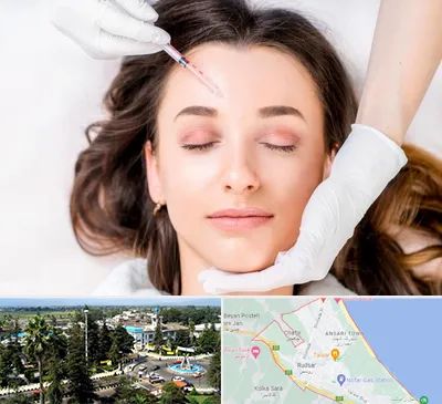 مزوتراپی ابرو در رودسر