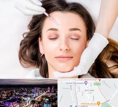 مزوتراپی ابرو در گلسار رشت 