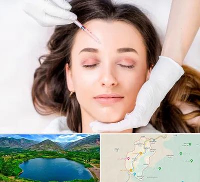 مزوتراپی ابرو در رودبار