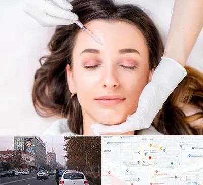 مزوتراپی ابرو در کارگر شمالی 