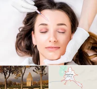 مزوتراپی ابرو در تویسرکان