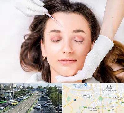 مزوتراپی ابرو در جنوب تهران 