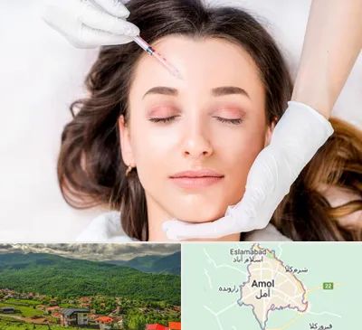 مزوتراپی ابرو در آمل