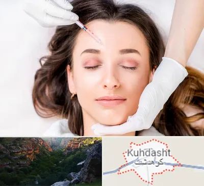 مزوتراپی ابرو در کوهدشت