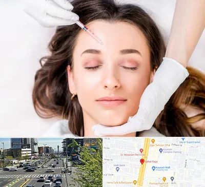 مزوتراپی ابرو در ستاری 