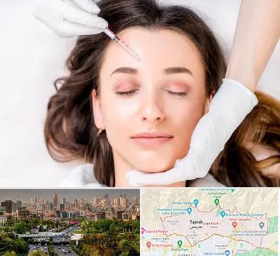 مزوتراپی ابرو در منطقه 1 تهران 