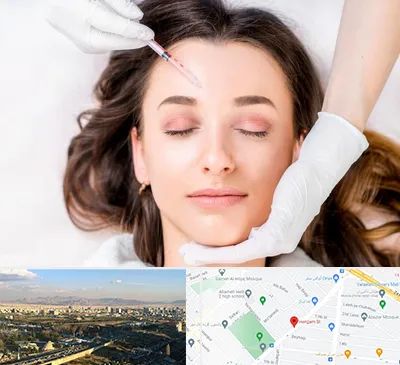 مزوتراپی ابرو در هنگام 