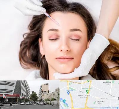 مزوتراپی ابرو در بلوار فردوس 