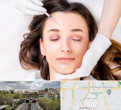 مزوتراپی ابرو در یوسف آباد 