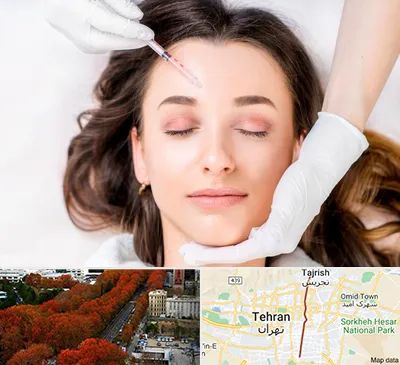 مزوتراپی ابرو در ولیعصر 