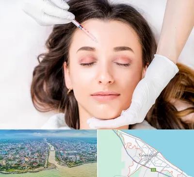 مزوتراپی ابرو در تنکابن