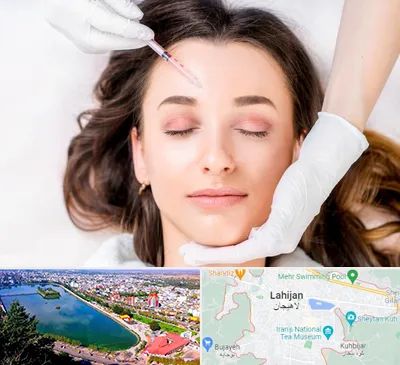 مزوتراپی ابرو در لاهیجان