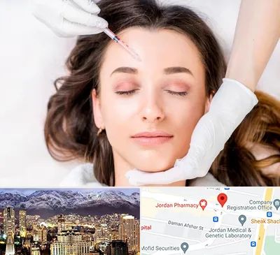 مزوتراپی ابرو در جردن 