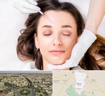 مزوتراپی ابرو در قزوین