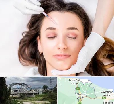 مزوتراپی ابرو در چالوس