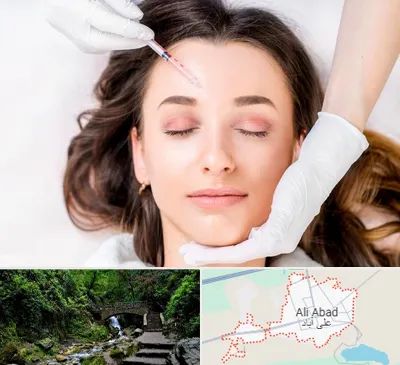 مزوتراپی ابرو در علی آباد کتول