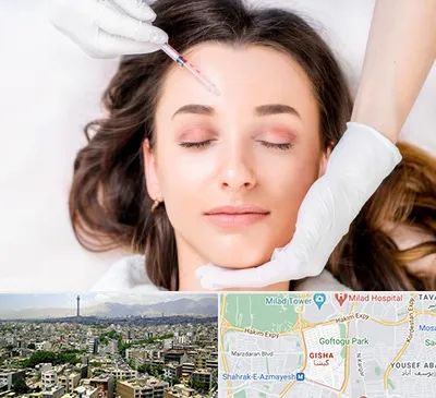 مزوتراپی ابرو در گیشا 