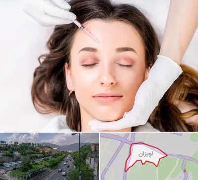مزوتراپی ابرو در لویزان