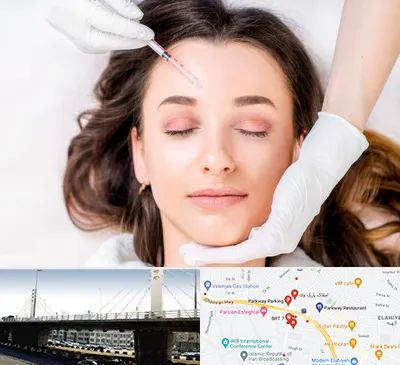 مزوتراپی ابرو در پارک وی 