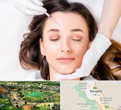 مزوتراپی ابرو در بروجرد