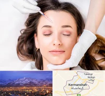 مزوتراپی ابرو در کرمانشاه