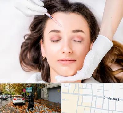 مزوتراپی ابرو در خیابان فلسطین