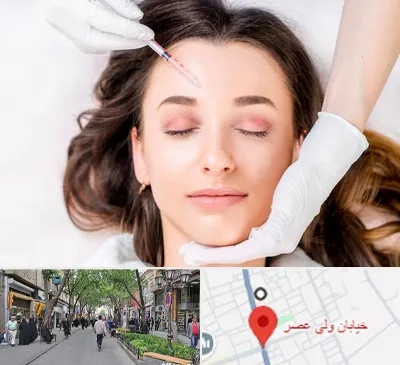 مزوتراپی ابرو در ولیعصر شهریار