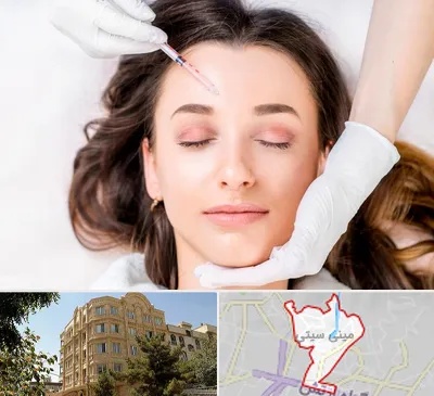 مزوتراپی ابرو در مینی سیتی