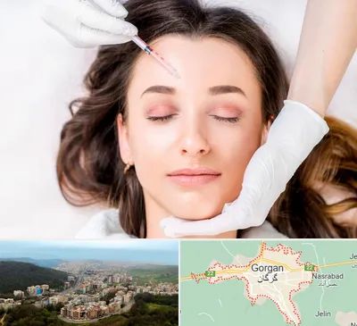 مزوتراپی ابرو در گرگان