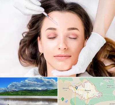 مزوتراپی ابرو در مرند