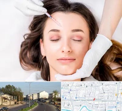 مزوتراپی ابرو در ضیابری رشت